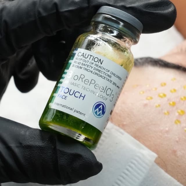 Glass Skin Peel Package at The OC Facialist in Orange, CA